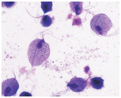  Zoomastigophora: ¿Una Maravilla Microscópica con Latidos de Agua?