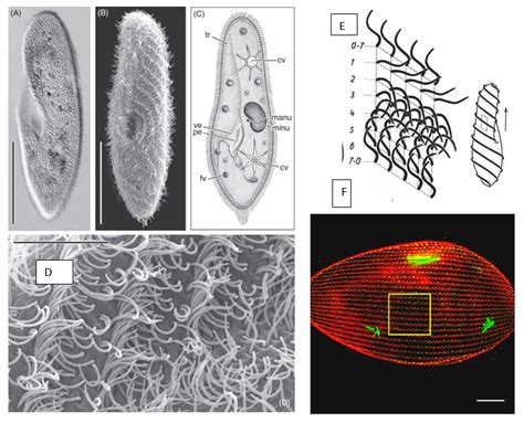  Paramecium: Un pequeño gigante con cilios que baila en un vals microscópico