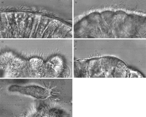 Zaprion Ciliata: Un Microscópico Cazador De Bacterias Que Baila Al Ritmo De Los Latidos Ciliares!